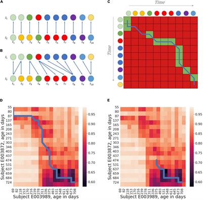 Temporal Alignment of Longitudinal Microbiome Data